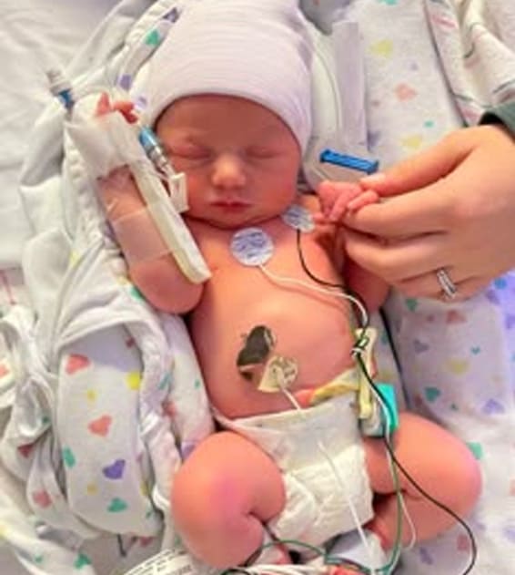 Neonatal Surgery